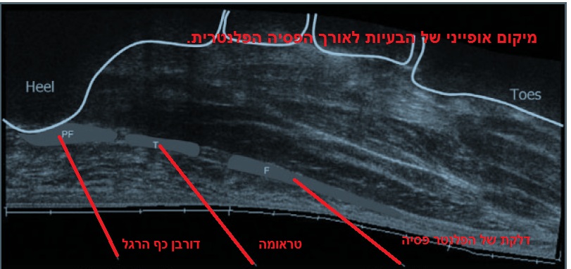 אולטראסאונד דורבן