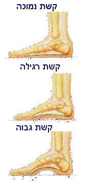 פלטפוס ברגל, רגל ניטראלית, קשת גבוה