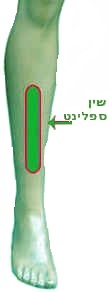 שין ספלינט