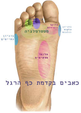 כאבים בכף הרגל הקדמית, מפה המציינת מיקום של הבעיות השונות והכאבים בכף הרגל הקדמית
