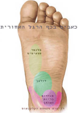 כאבים בכף רגל האחורית, מפה של כאבים המציינת היכן ממוקמת כל בעיה וכאבים בכף הרגל האחורית